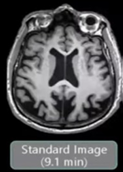 Standard MRI taken in 9.1 min